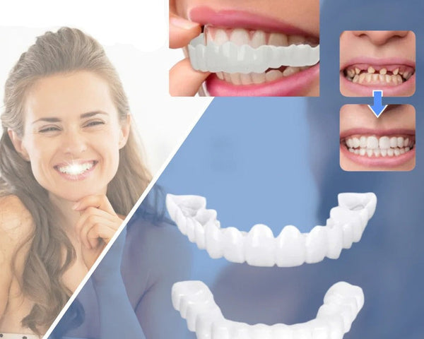 Snap-on Zähne™ - Mit diesen Veneers immer das perfekte Lächeln