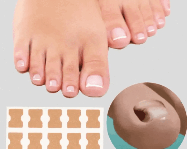 ToeCare™ - Ihre Lösung für eingewachsene Zehennägel!