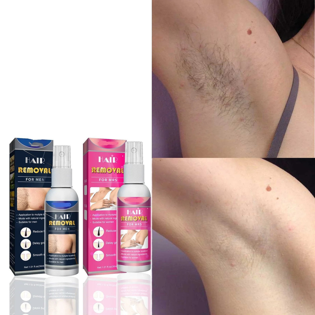 SilkMist™ Körperhaar-Entfernungsspray – Glatte Haut in wenigen Minuten