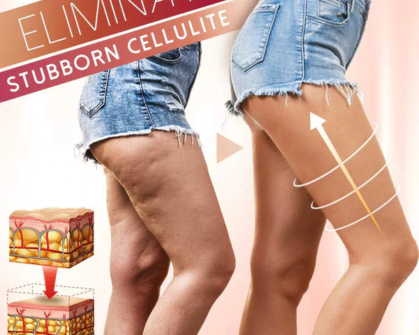 FatRelief™ - Straffende Massage für eine schlankere Silhouette und effektivere Gewichtsreduktion