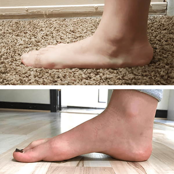 1+1 Gratis | SohlenEntlastung™ Sofortige Linderung von Fußschmerzen