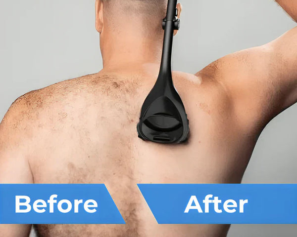 RückseiteGlatt™ Haarentferner für den Rücken