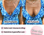 Klebepads™ Beidseitig haftende Nippelcover