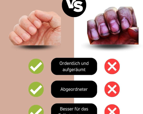 Clipparo™️ - Keine ungekämmten Nägel mehr (Letzter Tag 50% Rabatt)