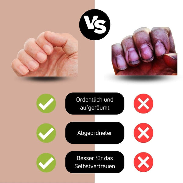 Clipparo™️ - Keine ungekämmten Nägel mehr (Letzter Tag 50% Rabatt)