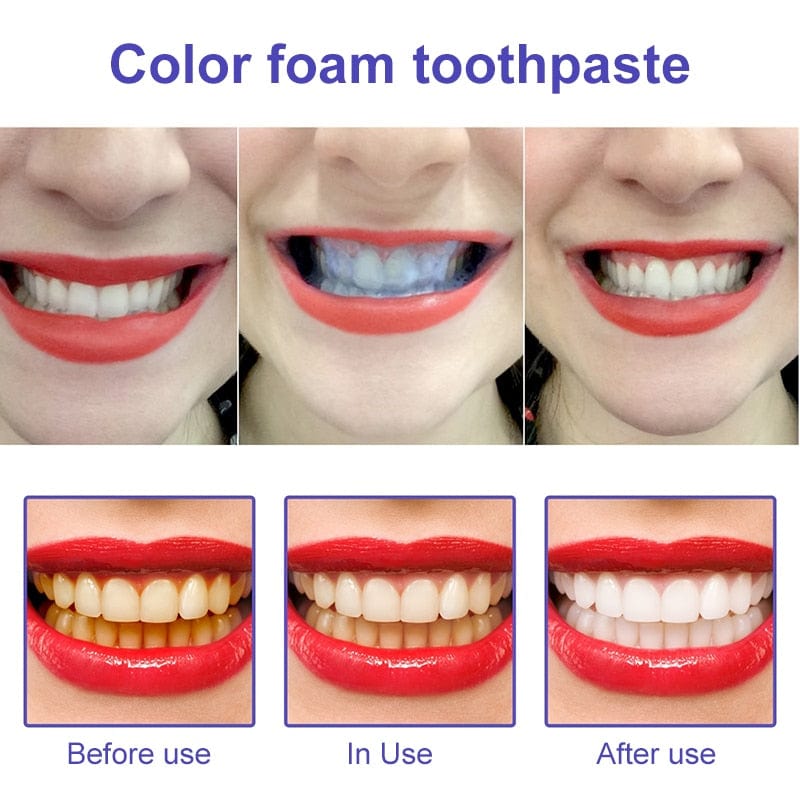 AufhellenPro™ Ultimative Whitening-Formel in nur wenigen Wochen