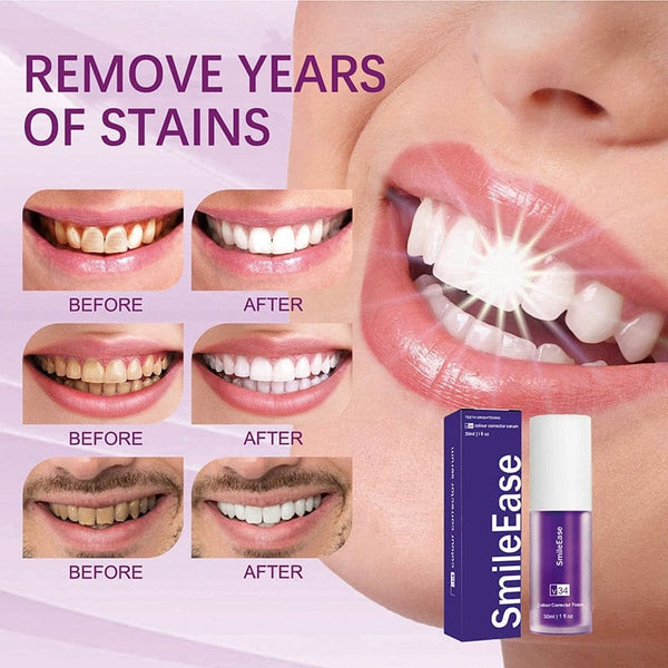 AufhellenPro™ Ultimative Whitening-Formel in nur wenigen Wochen