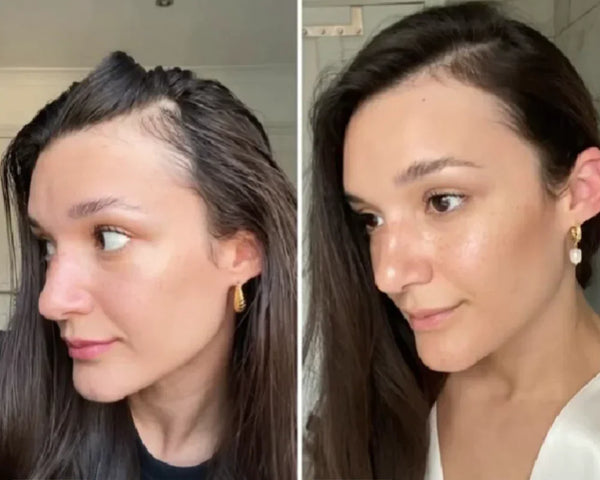 Carvenchy: Ihre natürliche Ölbehandlung für Haarwachstum
