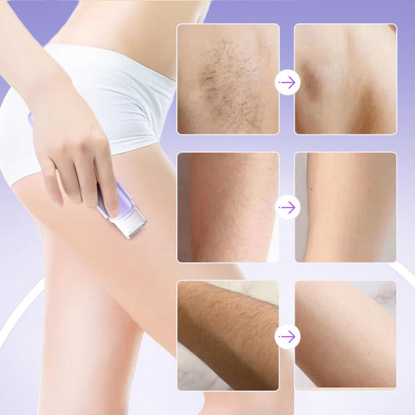 Velisse™ Damen-Multifunktionsrasierer mit Doppelkopf – Für Glatte Haut in Minuten