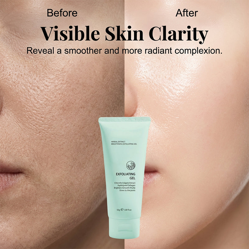 PureGlow™ Kräuter-Peeling Gel – Für Glatte, Strahlende & Reine Haut