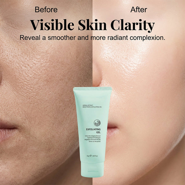 PureGlow™ Kräuter-Peeling Gel – Für Glatte, Strahlende & Reine Haut