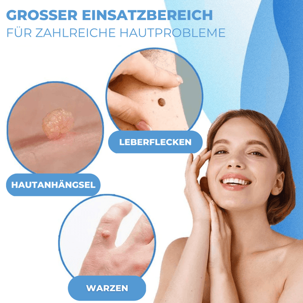 Warzen & Muttermale Entferner Set