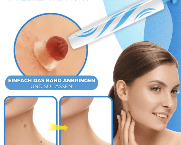 Warzen & Muttermale Entferner Set