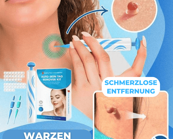 Warzen & Muttermale Entferner Set
